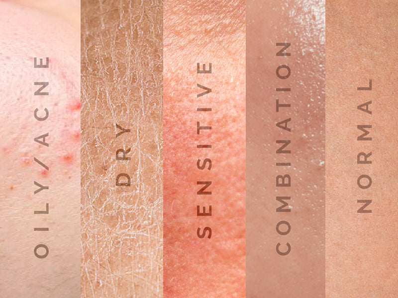 Types of Skin: An Insight Into Varied Skin Types – Know Your Skin Type